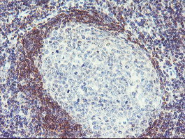 Immunohistochemical staining of paraffin-embedded Human tonsil within the normal limits using anti-PLDN mouse monoclonal antibody