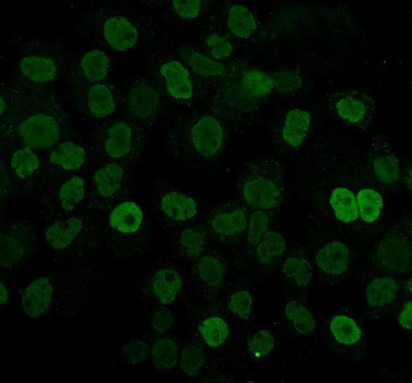 m09982 1 hnrnpd primary antibodies if testing 7