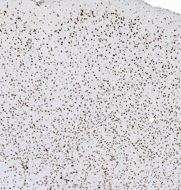 m09982 1 hnrnpd primary antibodies ihc testing 3