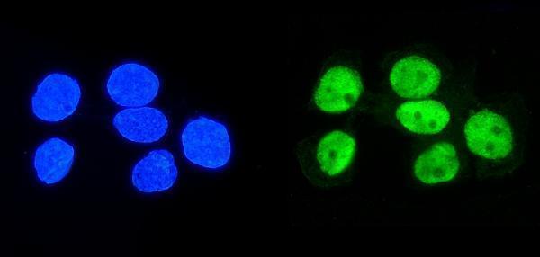 m09982 hnrnpd primary antibodies if testing 3