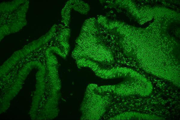 m09982 hnrnpd primary antibodies if testing 4