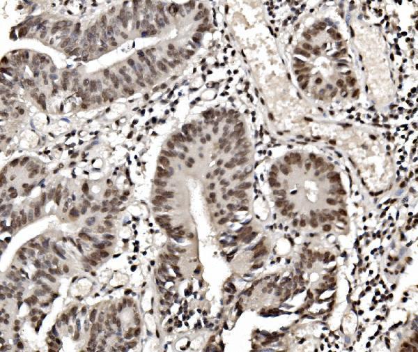 m09982 hnrnpd primary antibodies ihc testing 2