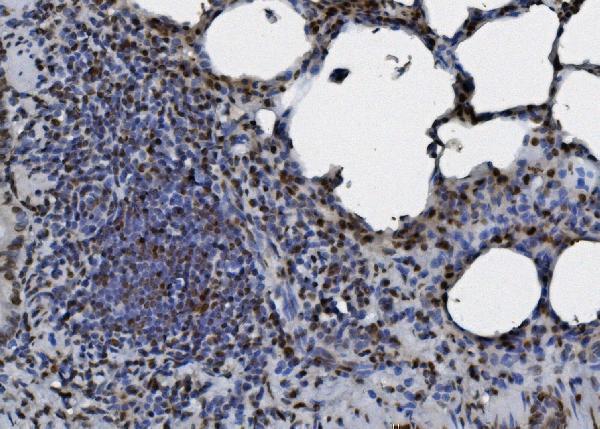 m09982 hnrnpd primary antibodies ihc testing 6