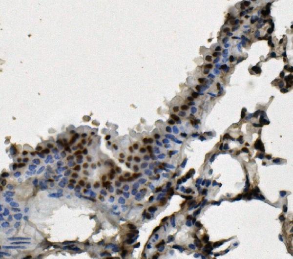 m09982 hnrnpd primary antibodies ihc testing 7