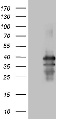 HEK293T cells were transfected with the pCMV6-ENTRY control (Left lane) or pCMV6-ENTRY PDCL3 (Right lane) cDNA for 48 hrs and lysed. Equivalent amounts of cell lysates (5 ug per lane) were separated by SDS-PAGE and immunoblotted with anti-PDCL3 (1:2000).