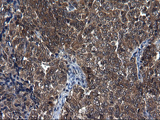 m10002 anti scrn1 mouse monoclonal antibody clone id oti1f2 ihc testing 6