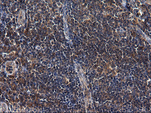 m10002 anti scrn1 mouse monoclonal antibody clone id oti1f2 ihc testing 8