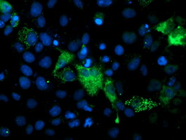 m10014 1 anti pgam2 mouse monoclonal antibody clone id oti2f5 if testing 3