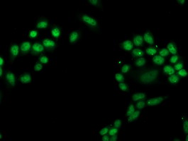 m10014 1 anti pgam2 mouse monoclonal antibody clone id oti2f5 if testing 4