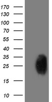 m10014 1 anti pgam2 mouse monoclonal antibody clone id oti2f5 wb testing 1