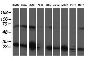 m10014 1 anti pgam2 mouse monoclonal antibody clone id oti2f5 wb testing 2