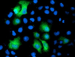 m10014 anti pgam2 mouse monoclonal antibody clone id oti4e9 if testing 5