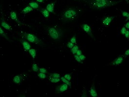 m10014 anti pgam2 mouse monoclonal antibody clone id oti4e9 if testing 6