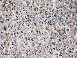 Immunohistochemical staining of paraffin-embedded Human liver tissue within the normal limits using anti-PGAM2 mouse monoclonal antibody