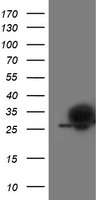 HEK293T cells were transfected with the pCMV6-ENTRY control (Left lane) or pCMV6-ENTRY PGAM2 (Right lane) cDNA for 48 hrs and lysed