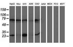 Western blot analysis of extracts (35ug) from 9 different cell lines by using anti-PGAM2 monoclonal antibody