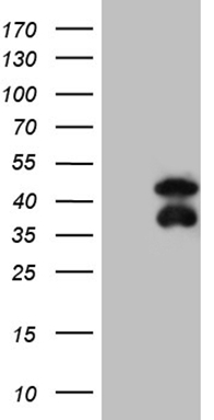 HEK293T cells were transfected with the pCMV6-ENTRY control (Left lane) or pCMV6-ENTRY BCL7B (Right lane) cDNA for 48 hrs and lysed