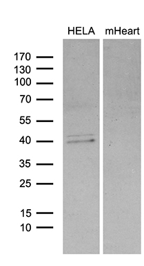 Western blot analysis of extracts (35ug) from HELA cell line and mouse heart tissue lysate by using anti-BCL7B monoclonal antibody (1:500)