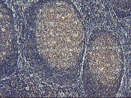 Immunohistochemical staining of paraffin-embedded Human tonsil within the normal limits using anti-ASCC1 mouse monoclonal antibody. (Heat-induced epitope retrieval by 10mM citric buffer