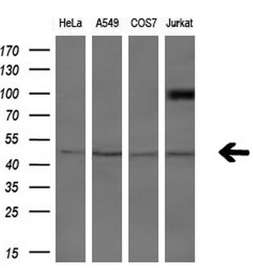 Western blot analysis of extracts (10ug) from 4 different cell lines by using anti-ASCC1 monoclonal antibody (1:200).