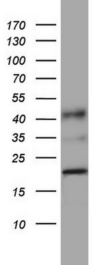 Western blot analysis of A549 cell lysate (35ug) by using anti-PPIH monoclonal antibody