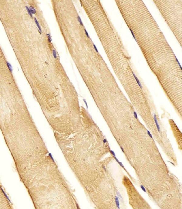 M10029 staining CHST1 in Human skeletal muscle tissue sections by Immunohistochemistry (IHC-P -paraformaldehyde-fixed, paraffin-embedded sections). Tissue was fixed with formaldehyde and blocked with 3% BSA for 0. 5 hour at room temperature; antigen retrieval was by heat mediation with a citrate buffer (pH6). Samples were incubated with primary antibody (1/25) for 1 hours at 37°C. A undiluted biotinylated goat polyvalent antibody was used as the secondary antibody.