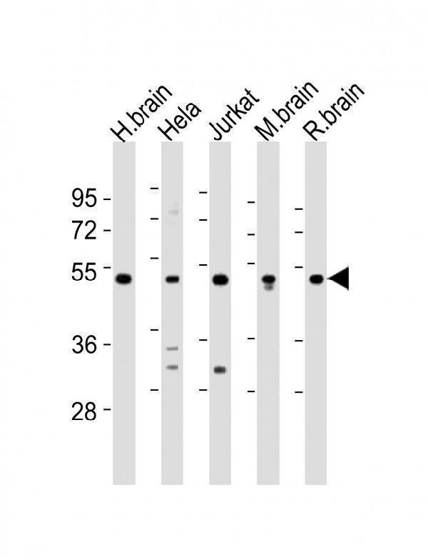 All lanes : Anti-CHST1 Antibody (C-term) at 1:2000 dilution Lane 1: human brain lysates Lane 2: Hela whole cell lysates Lane 3: Jurkat whole cell lysates Lane 4: mouse brain lysates Lane 5: rat brain lysates Lysates/proteins at 20 microg per lane. Secondary Goat Anti-Rabbit IgG, (H+L), Peroxidase conjugated at 1/10000 dilution Predicted band size : 47 kDa Blocking/Dilution buffer: 5% NFDM/TBST.