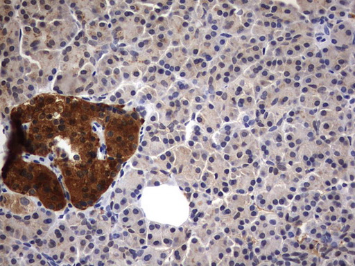 m10048 anti csnk1g2 mouse monoclonal antibody clone id oti4h3 ihc testing 2
