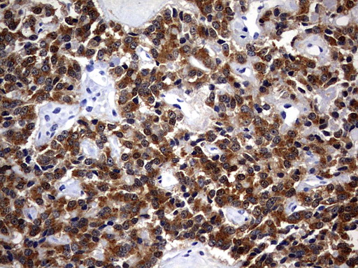 m10048 anti csnk1g2 mouse monoclonal antibody clone id oti4h3 ihc testing 3