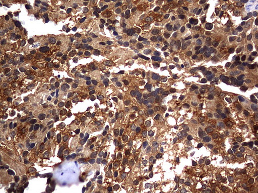 m10048 anti csnk1g2 mouse monoclonal antibody clone id oti4h3 ihc testing 4