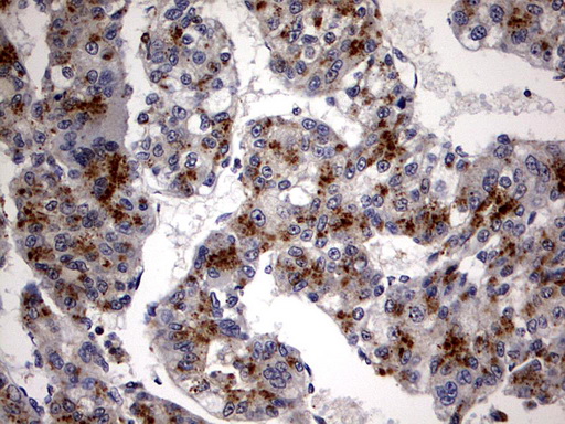 m10048 anti csnk1g2 mouse monoclonal antibody clone id oti4h3 ihc testing 5