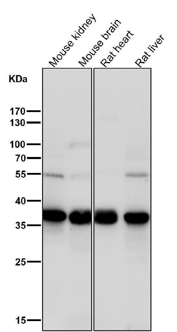 All lanes use the Antibody at 1:1K dilution for 1 hour at room temperature