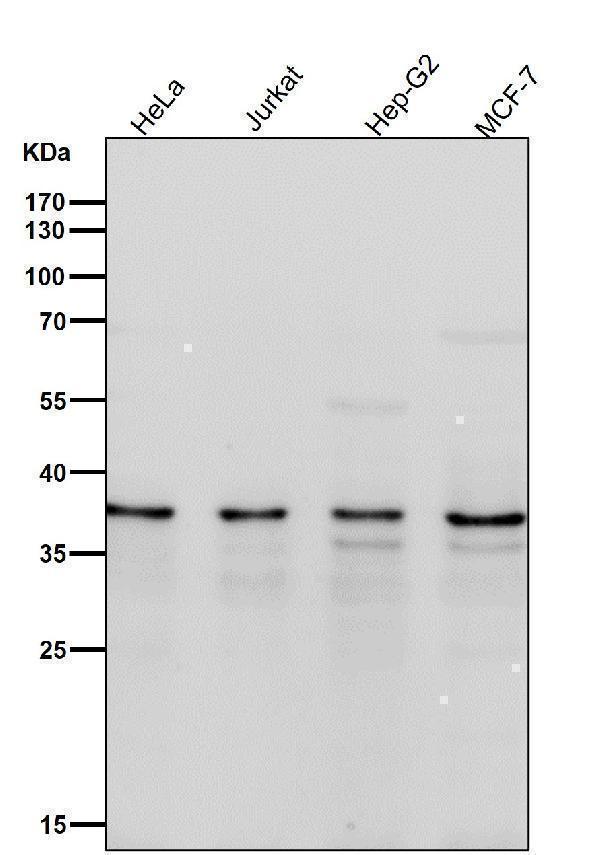 All lanes use the Antibody at 1:1K dilution for 1 hour at room temperature