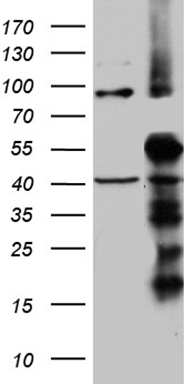 m10056 anti timm50 mouse monoclonal antibody clone id oti1e9 wb testing 1