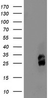 m10103 1 anti pmvk mouse monoclonal antibody clone id oti2d1 wb testing 1