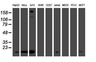 m10103 1 anti pmvk mouse monoclonal antibody clone id oti2d1 wb testing 2