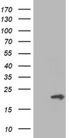 m10103 anti pmvk mouse monoclonal antibody clone id oti2f9 wb testing 1