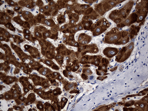 m10113 anti genethonin 1 stbd1 mouse monoclonal antibody clone id oti2f1 ihc testing 4