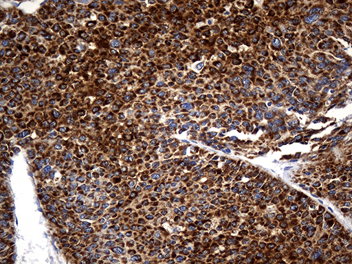 m10113 anti genethonin 1 stbd1 mouse monoclonal antibody clone id oti2f1 ihc testing 5