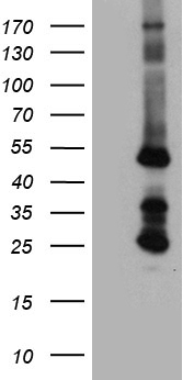 HEK293T cells were transfected with the pCMV6-ENTRY control (Left lane) or pCMV6-ENTRY STBD1 (Right lane) cDNA for 48 hrs and lysed
