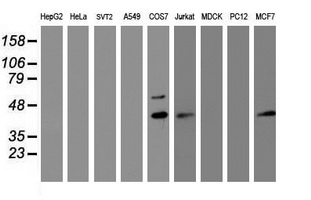 Western blot analysis of extracts (35ug) from 9 different cell lines by using anti-PRR11 monoclonal antibody (HepG2: human; HeLa: human; SVT2: mouse; A549: human; COS7: monkey; Jurkat: human; MDCK: canine; PC12: rat; MCF7: human). Western blot analysis of extracts (35ug) from 9 different cell lines by using anti-PRR11 monoclonal antibody (HepG2: human; HeLa: human; SVT2: mouse; A549: human; COS7: monkey; Jurkat: human; MDCK: canine; PC12: rat; MCF7: human).