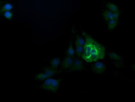 m10133 1 anti trim38 mouse monoclonal antibody clone id oti15a3 if testing 5