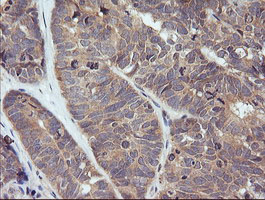 m10133 1 anti trim38 mouse monoclonal antibody clone id oti15a3 ihc testing 2