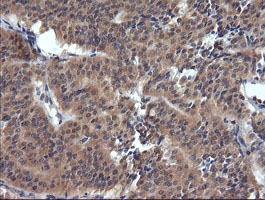 m10133 1 anti trim38 mouse monoclonal antibody clone id oti15a3 ihc testing 3
