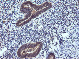 m10133 1 anti trim38 mouse monoclonal antibody clone id oti15a3 ihc testing 4