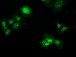 m10149 anti pbld mouse monoclonal antibody clone id oti7g5 if testing 4