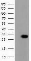 HEK293T cells were transfected with the pCMV6-ENTRY control (Left lane) or pCMV6-ENTRY PBLD (Right lane) cDNA for 48 hrs and lysed