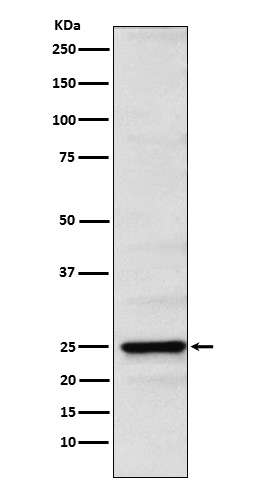 Western blot analysis of Neurogenin 2 expression in SH-SY5Y cell lysate.