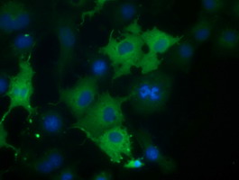 m10210 anti coro1b mouse monoclonal antibody clone id oti3d10 if testing 5