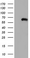 HEK293T cells were transfected with the pCMV6-ENTRY control (Left lane) or pCMV6-ENTRY CORO1B (Right lane) cDNA for 48 hrs and lysed
